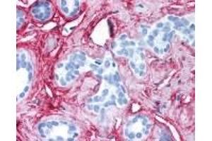 Immunohistochemistry (IHC) image for anti-Collagen, Type VI, alpha 1 (COL6A1) antibody (ABIN2470329)