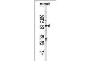Western blot analysis of ZBTB7B Antibody (Center) Pab (ABIN390349 and ABIN2840763) in mouse brain tissue lysates (35 μg/lane). (ZBTB7B anticorps  (AA 181-210))