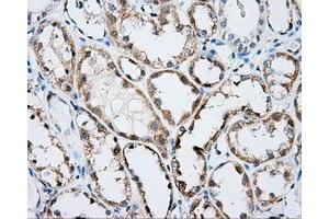 Immunohistochemical staining of paraffin-embedded prostate tissue using anti-ARHGDIA mouse monoclonal antibody.