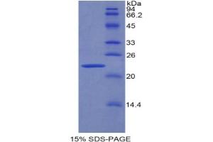 SDS-PAGE analysis of Rat PPARG Protein.