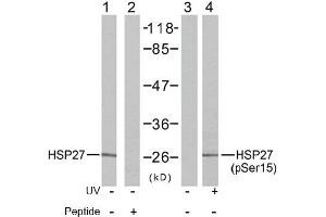 Image no. 2 for anti-Heat Shock 27kDa Protein 1 (HSPB1) (Ser15) antibody (ABIN197344) (HSP27 anticorps  (Ser15))