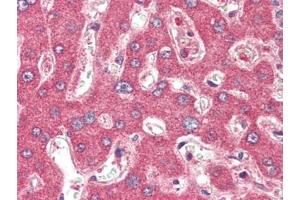 Human Liver (formalin-fixed, paraffin-embedded) stained with TSLPat 2. (Thymic Stromal Lymphopoietin anticorps)