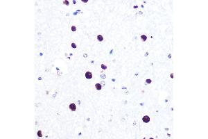 Immunohistochemistry of paraffin-embedded mouse spinal cord using MITF Rabbit mAb (ABIN7268511) at dilution of 1:100 (40x lens).