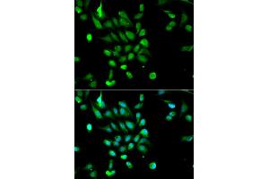 Immunofluorescence analysis of MCF-7 cells using PSMC5 antibody.