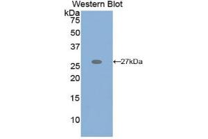 Western blot analysis of the recombinant protein. (GRIP1 anticorps  (AA 874-1073))