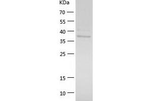 Western Blotting (WB) image for Creatine Kinase, Muscle (CKM) (AA 1-381) protein (His tag) (ABIN7122495) (CKM Protein (AA 1-381) (His tag))