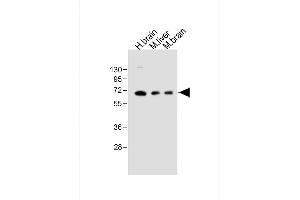 All lanes : Anti-GLS2 Antibody (C-term ) at 1:1000 dilution Lane 1: Human brain lysate Lane 2: Mouse liver lysate Lane 3: Mouse brain lysate Lysates/proteins at 20 μg per lane. (GLS2 anticorps  (AA 498-524))
