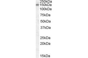 Western Blotting (WB) image for anti-Deoxyribose-Phosphate Aldolase (DERA) (N-Term) antibody (ABIN2789516)
