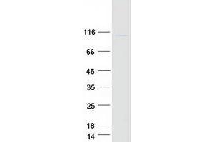 Validation with Western Blot