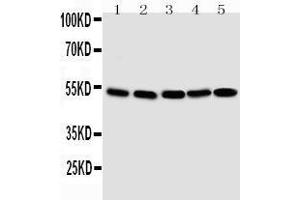Anti-Smad1 antibody, Western blotting Lane 1: SMMC Cell Lysate Lane 2: K562 Cell Lysate Lane 3:  Cell Lysate Lane 4: HELA Cell Lysate Lane 5: JURKAT Cell Lysate (SMAD1 anticorps  (C-Term))