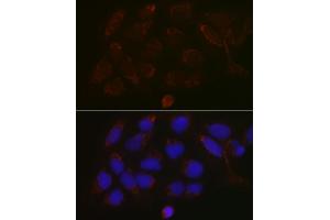 Immunofluorescence analysis of U-2 OS cells using G Rabbit pAb (ABIN6131444, ABIN6140942, ABIN6140944 and ABIN6218180) at dilution of 1:100 (40x lens). (GALNT3 anticorps  (AA 1-140))