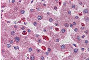 Human Liver: Formalin-Fixed, Paraffin-Embedded (FFPE)