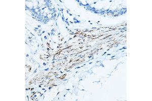 Immunohistochemistry of paraffin-embedded human colon using Desminmin Rabbit pAb (ABIN3021114, ABIN3021115, ABIN3021116 and ABIN6213957) at dilution of 1:100 (40x lens).