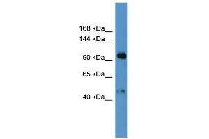 WB Suggested Anti-LPA Antibody Titration: 0. (LPA anticorps  (N-Term))
