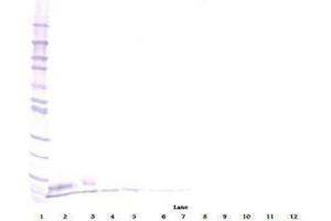 Image no. 2 for anti-Epidermal Growth Factor (EGF) antibody (ABIN465058) (EGF anticorps)