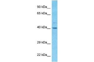 Host:  Rabbit  Target Name:  ALDOA  Sample Type:  RPMI-8226 Whole Cell lysates  Antibody Dilution:  1.