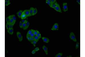 Immunofluorescence staining of HepG2 cells with ABIN7155172 at 1:166, counter-stained with DAPI. (SLC7A1 anticorps  (AA 430-492))