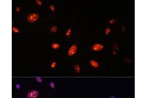 Immunofluorescence analysis of U-2 OS cells using ZNF177 Polyclonal Antibody at dilution of 1:100. (ZNF177 anticorps)