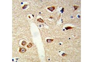 IHC analysis of FFPE mouse brain tissue stained with TLR3 antibody (TLR3 anticorps)