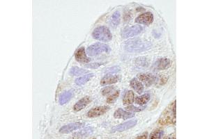 Immunohistochemistry (IHC) image for anti-Prohibitin 2 (PHB2) (AA 1-50) antibody (ABIN7448768) (Prohibitin 2 anticorps  (AA 1-50))