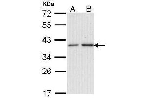 WB Image Sample (30 ug of whole cell lysate) A: A431 , B: H1299 12% SDS PAGE antibody diluted at 1:1000 (NAT2 anticorps)