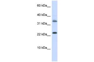 WB Suggested Anti-EMX1 Antibody Titration:  0. (EMX1 anticorps  (Middle Region))