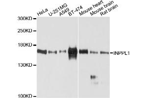 Western blot analysis of extracts of various cell lines, using INPPL1 antibody (ABIN4904065) at 1:1000 dilution. (INPPL1 anticorps)