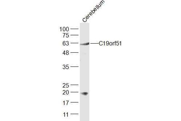 DNAAF3 anticorps  (AA 151-250)