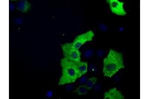 Image no. 7 for anti-Transforming, Acidic Coiled-Coil Containing Protein 3 (TACC3) antibody (ABIN1498099) (TACC3 anticorps)