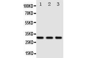 Anti-DR4 antibody, Western blotting Lane 1: SW620 Cell Lysate Lane 2: COLO320 Cell Lysate Lane 3:  Cell Lysate (TNFRSF10A anticorps  (N-Term))