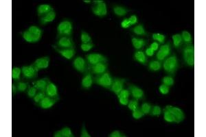 Immunofluorescence staining of Hela cells with ABIN7157277 at 1:100, counter-stained with DAPI.