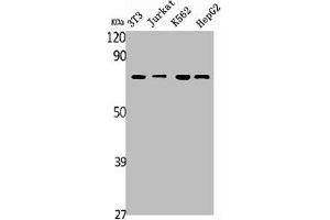 Western Blot analysis of NIH-3T3 Jurkat K562 HepG2 RAT-KIDNEY cells using SDHA Polyclonal Antibody (SDHA anticorps  (C-Term))