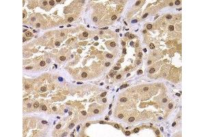 Immunohistochemistry of paraffin-embedded Human kidney using CSRP2BP Polyclonal Antibody at dilution of 1:100 (40x lens). (CSRP2BP anticorps)