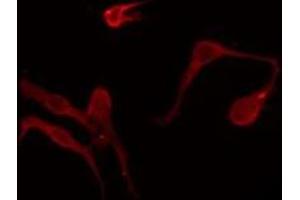 ABIN6275928 staining MCF7 by IF/ICC.