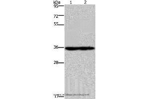 Western blot analysis of Mouse heart and kidney tissue, using NDUFA9 Polyclonal Antibody at dilution of 1:400 (NDUFA9 anticorps)