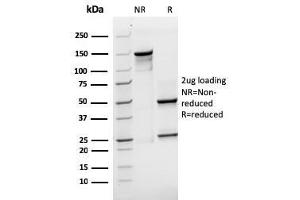 SDS-PAGE Analysis Purified SOX2 Recombinant Mouse Monoclonal Antibody (rSOX2/1791).