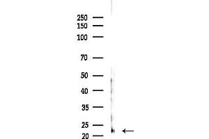 Western blot analysis of lysates from Hela cells(heat-shock,45 min treatment), using REEP6 Antibody at 1/1000 dilution. (REEP6 anticorps  (C-Term))