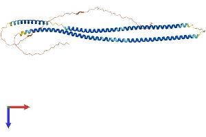 Keratin 40 (KRT40) (AA 1-431) protein (His tag)