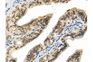 Phospho-EZH2 (Ser21) Antibody at 1/100 staining Rat ovarian tissue by IHC-P.