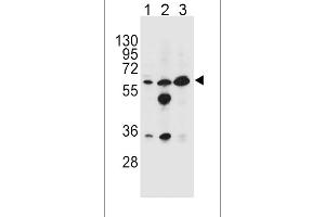Western blot analysis in HL-60(lane 1),MDA-MB453(lane 2),K562(lane 3) cell line lysates (35ug/lane). (GATM anticorps  (N-Term))