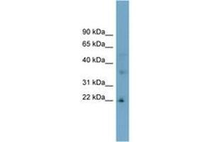 anti-Low Density Lipoprotein Receptor Class A Domain Containing 1 (LDLRAD1) (AA 107-156) antibody
