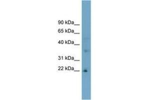 Image no. 1 for anti-Low Density Lipoprotein Receptor Class A Domain Containing 1 (LDLRAD1) (AA 107-156) antibody (ABIN6743318) (LDLRAD1 anticorps  (AA 107-156))
