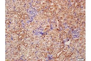 Formalin-fixed and paraffin embedded rat kidney labeled with Anti-Beclin 1/ATG6 Polyclonal Antibody, Unconjugated  at 1:200 followed by conjugation to the secondary antibody and DAB staining (Beclin 1 anticorps  (AA 201-330))