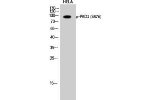 Western Blotting (WB) image for anti-Polycystic Kidney Disease 2 (Autosomal Dominant) (PKD2) (pSer876) antibody (ABIN5962048) (PKD2 anticorps  (pSer876))
