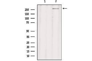 Western blot analysis of extracts from rat brain, using CHD8 Antibody.