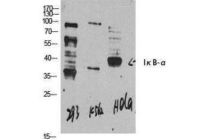 Western Blotting (WB) image for anti-Nuclear Factor of kappa Light Polypeptide Gene Enhancer in B-Cells Inhibitor, alpha (NFKBIA) (N-Term) antibody (ABIN3175722) (NFKBIA anticorps  (N-Term))