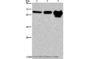 Western blot analysis of 823 cell, mouse brain and human fetal brain tissue, using MMP20 Polyclonal Antibody at dilution of 1:400