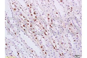 Formalin-fixed and paraffin embedded rat kidney tissue labeled with Anti ZHX2/Alpha fetoprotein regulator 1 Polyclonal Antibody, Unconjugated (ABIN873226) at 1:100 followed by conjugation to the secondary antibody and DAB staining (ZHX2 anticorps  (AA 451-550))
