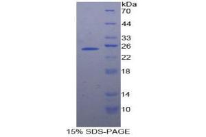 SDS-PAGE analysis of Human SMC3 Protein. (SMC3 Protéine)