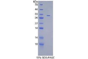 SDS-PAGE analysis of Mouse ANGPTL2 Protein.